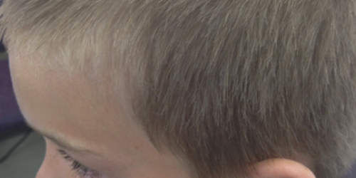 Fish Hook in the Head and Big Birthday Bash