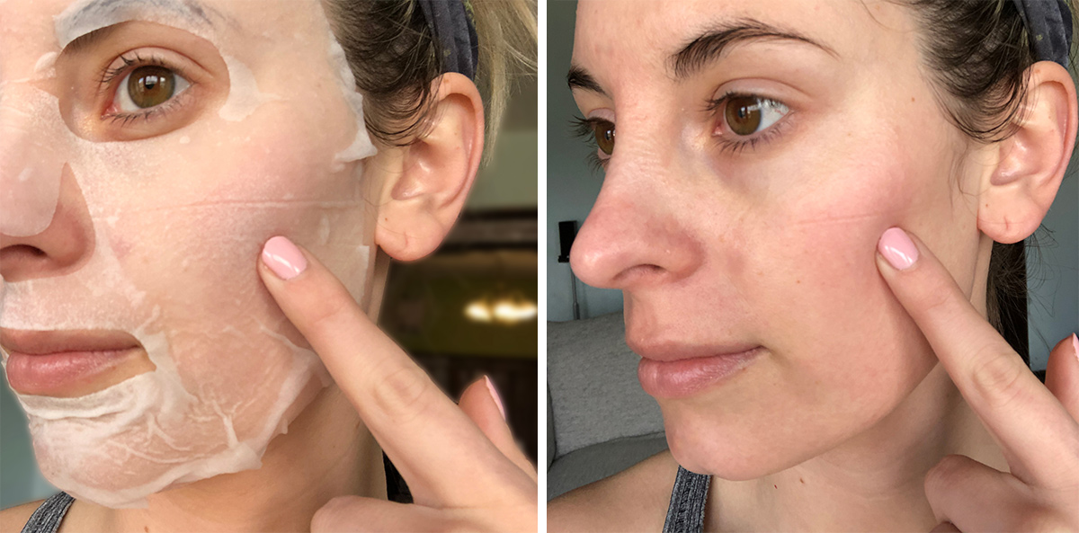 before and after of wearing a sheet mask and resulting in a line in skin