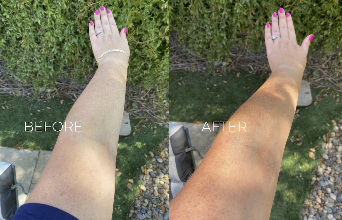 before and after with arm and self tanner