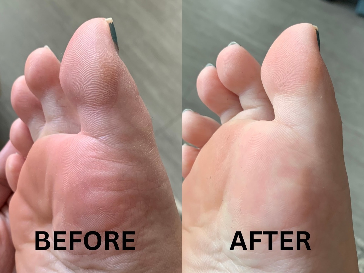 Flirty Feet before and after pictures