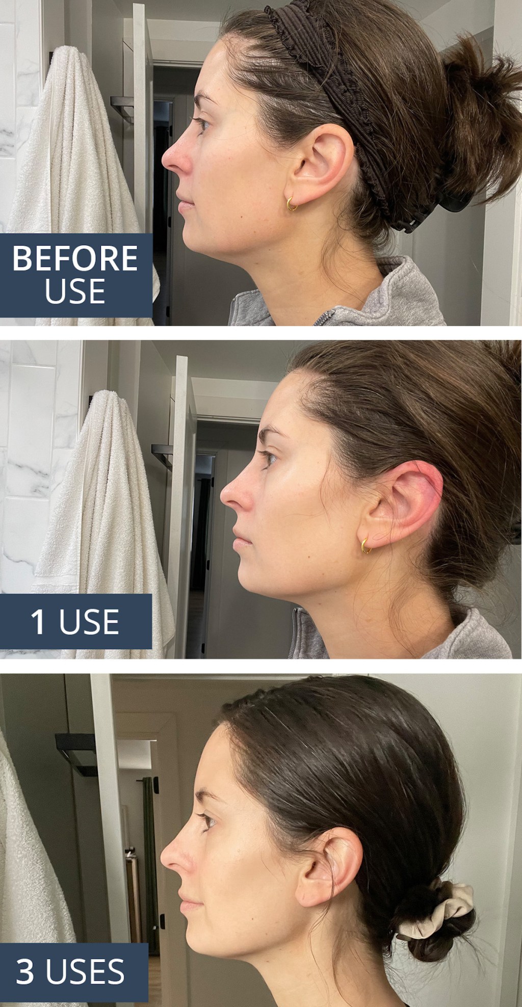 before and after of woman side profile